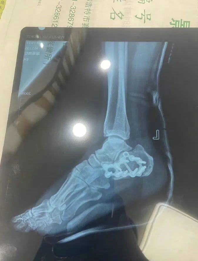 1700732963355055.jpg 3.jpg